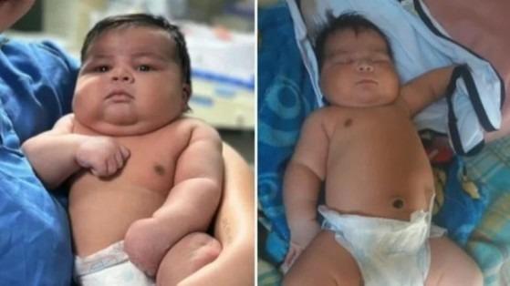 Bebê Gigante de 6,5 kg Nasce de Parto Normal e Mãe Precisa de 55 Pontos