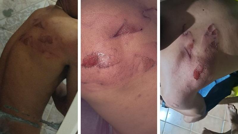 Trabalhadores são espancados com facão e ameaçados por patrões armados em alojamento