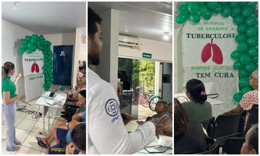 Tuberculose em Rosário Oeste: PSF 1 Alerta para Sintomas e Tratamento Rápido