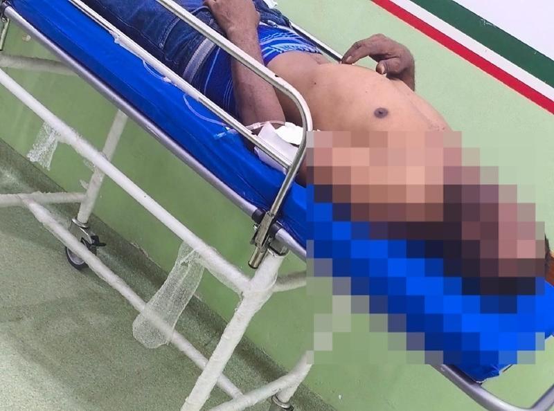 Homem descumpre medida protetiva, invade casa da ex e é esfaqueado em VG