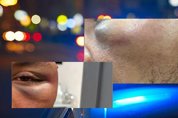 Homem leva murro no olho após dizer que era PT durante discussão em conveniência em Sorriso