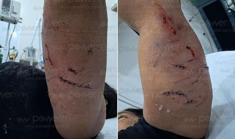 Mulher é atacada por cachorro ao tentar proteger pets e fica ferida em Nova Mutum