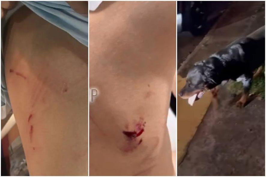 Rottweiler ataca duas crianças em praça de cidade de MT; vídeo