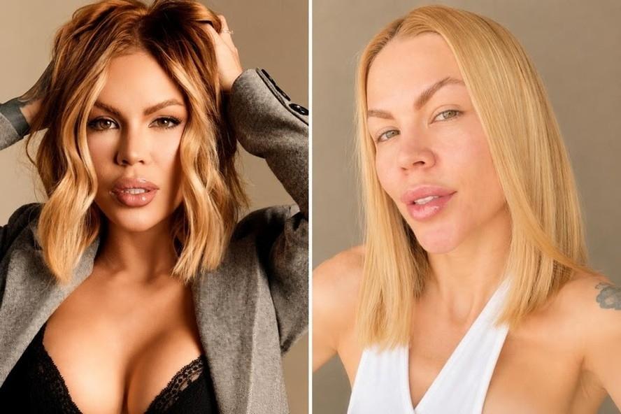 Influencer gasta mais de R$ 100 mil com reversão de procedimentos: 'Desfazer meu rosto'