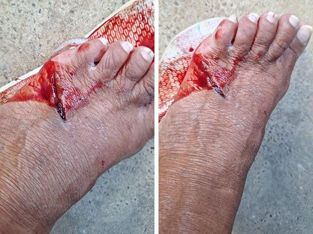 Mulher foi atacada por cachorro em Sorriso e fica internada