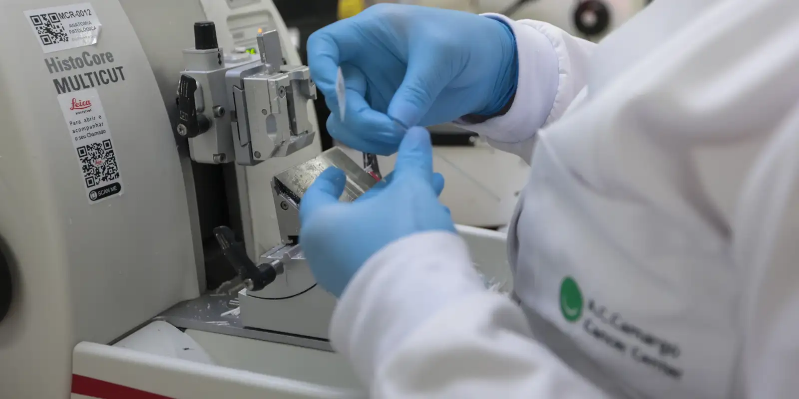 SUS incorpora terapia combinada com venetoclax e azacitidina para leucemia mieloide aguda