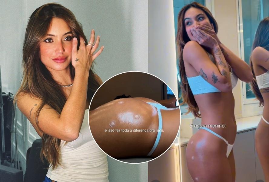 Vanessa Lopes sobre harmonização no bumbum: 'Fez toda a diferença para mim'