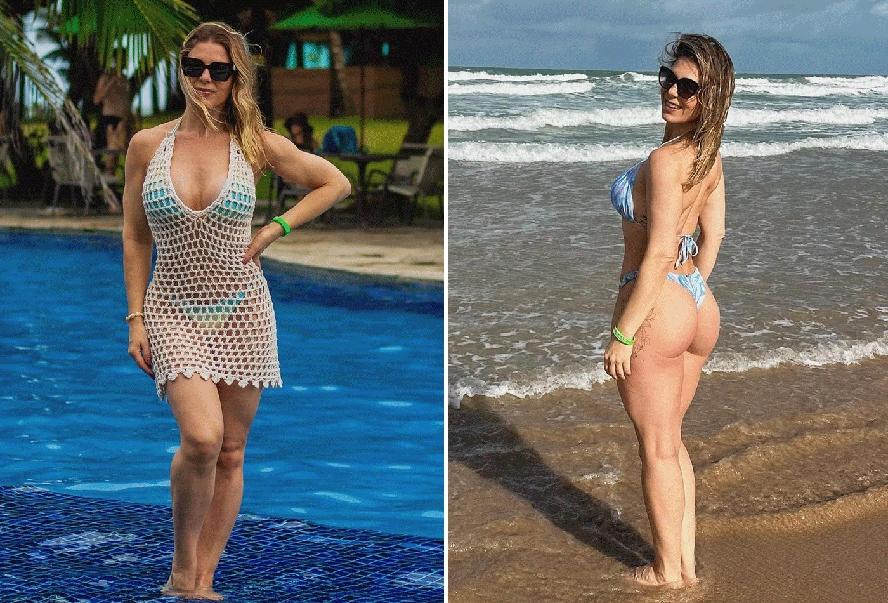 Sheila Mello faz tratamento com colágeno no bumbum: entenda em que casos a técnica realmente funciona
