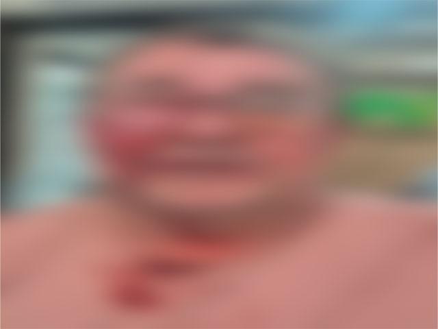 Homem foi agredido com chutes no rosto após pedir que enteado abaixasse volume do som em Sorriso