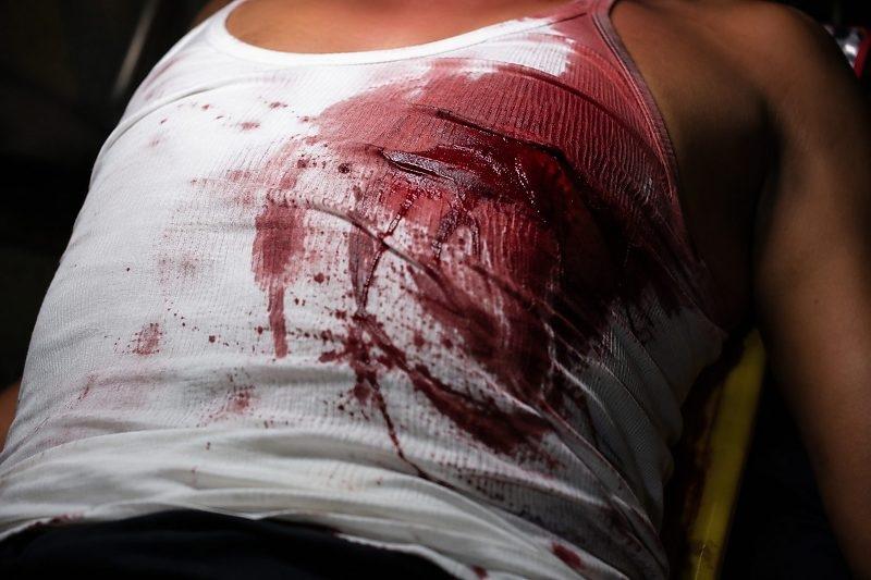 Mulher é encontrada ensanguentada após ser esfaqueada no peito em Confresa
