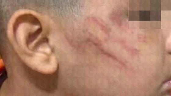 Pai é investigado após agredir filho autista de 10 anos, que desmaiou durante confusão em Lucas do Rio Verde