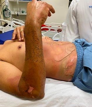 Trabalhador sofre descarga elétrica, cai de andaime e é socorrido às pressas