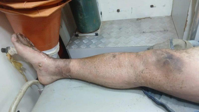 Descarga elétrica arremessa trabalhador contra parede durante acidente em MT