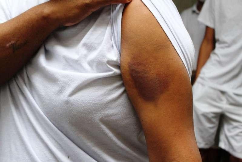 Facção ordena castigo com 20 golpes nas mãos de mulher e três suspeitos acabam presos