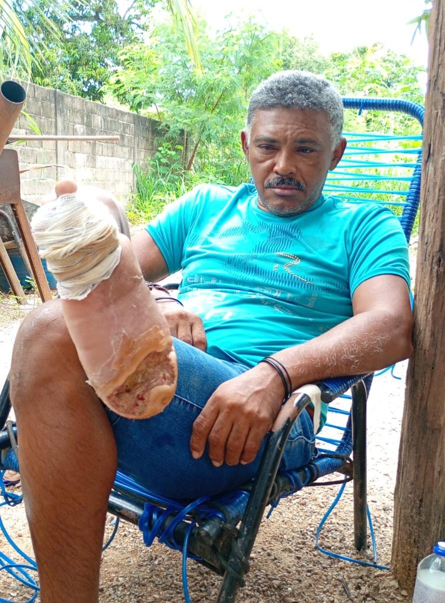 Homem de 53 anos anos pede ajuda para continuar tratamento em Nobres 
