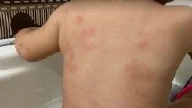 Médica desconfia de queda relatada por mãe e aciona Conselho Tutelar após atender criança em MT