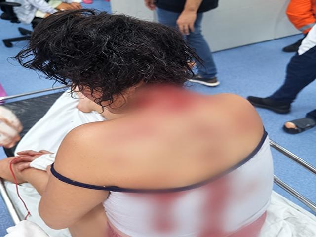 Mulher é atingida por tesourada na cabeça durante briga em boate de Sorriso; suspeita é presa