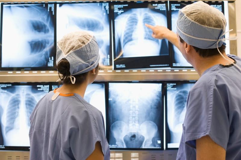 Novo protocolo de tratamento do câncer de pulmão propõe ampliar o acesso à cirurgia torácica assistida por vídeo para pacientes do SUS