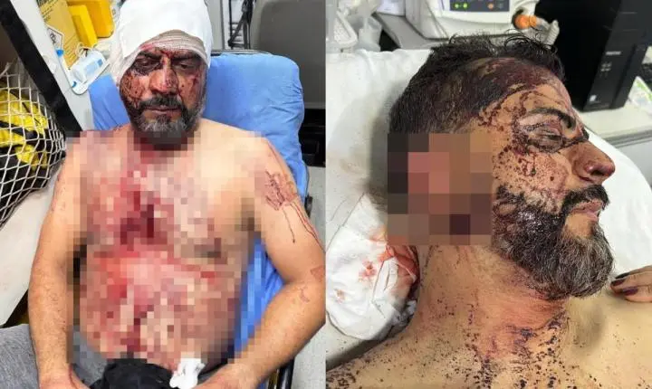 Bandidos exigem R$ 1 milhão, cortam orelha de vereador e ameaçam arrancar braço do filho