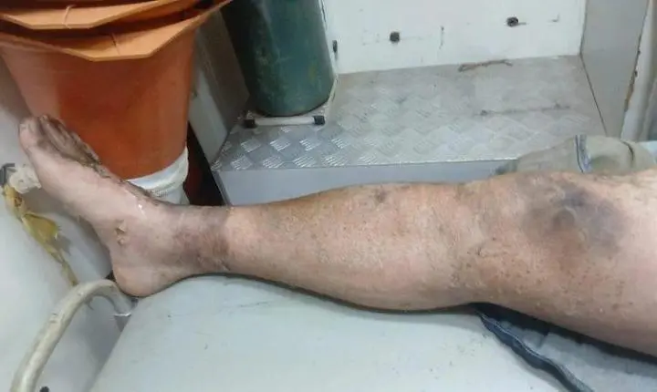 Descarga elétrica arremessa trabalhador contra parede durante acidente em MT
