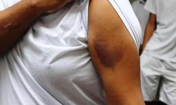 Facção ordena castigo com 20 golpes nas mãos de mulher e três suspeitos acabam presos
