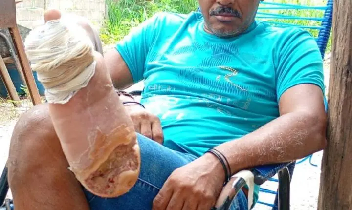 Homem de 53 anos anos pede ajuda para continuar tratamento em Nobres 