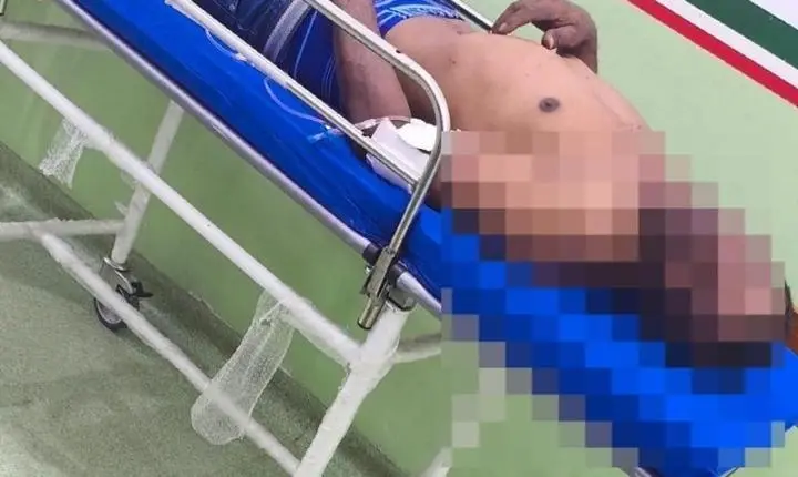 Homem descumpre medida protetiva, invade casa da ex e é esfaqueado em VG