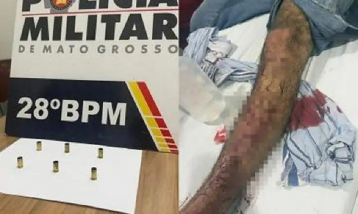 Homem é baleado durante tentativa de homicídio em Jaciara