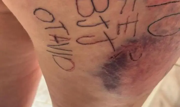 Homem é preso suspeito de torturar, mutilar e tatuar companheira à força