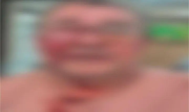 Homem foi agredido com chutes no rosto após pedir que enteado abaixasse volume do som em Sorriso