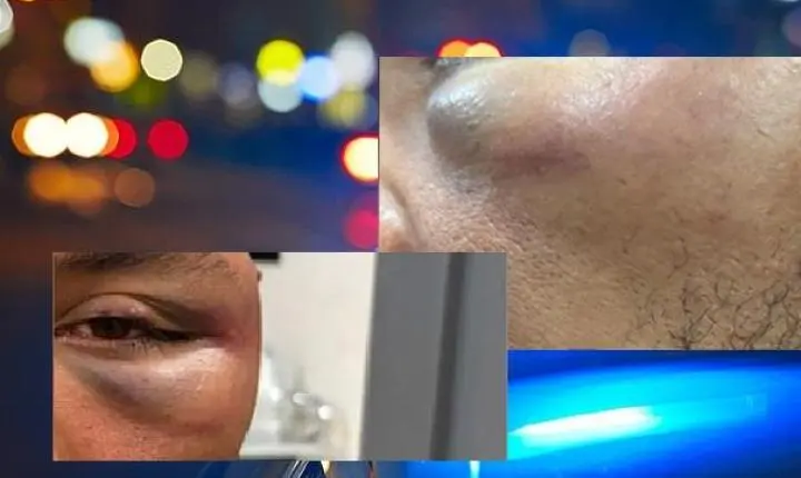 Homem leva murro no olho após dizer que era PT durante discussão em conveniência em Sorriso