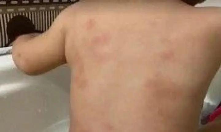 Médica desconfia de queda relatada por mãe e aciona Conselho Tutelar após atender criança em MT