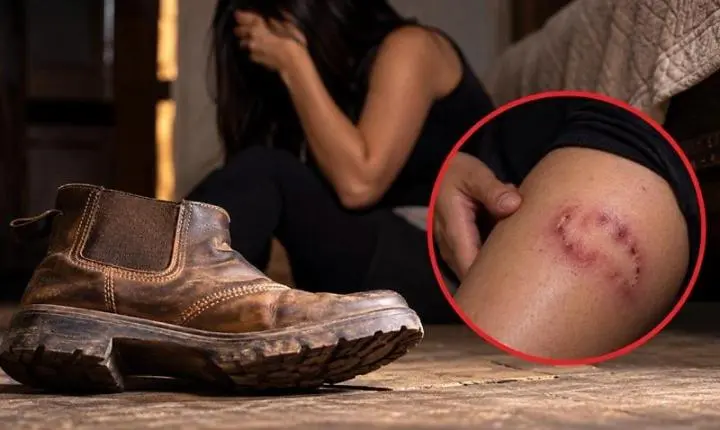 Mulher denuncia agressão com botina e mordidas após marido ler mensagens em MT