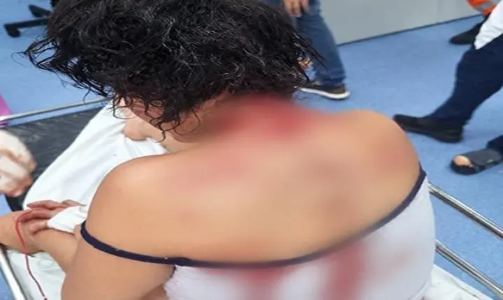 Mulher é atingida por tesourada na cabeça durante briga em boate de Sorriso; suspeita é presa