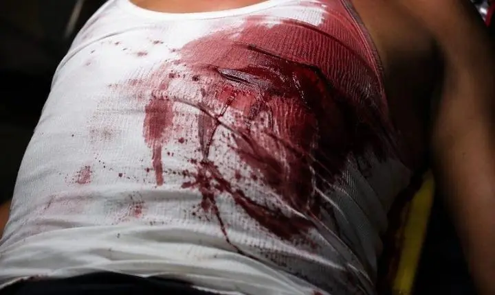 Mulher é encontrada ensanguentada após ser esfaqueada no peito em Confresa