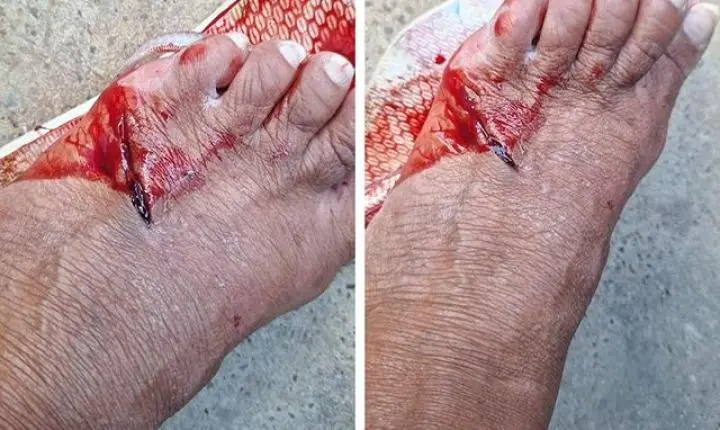 Mulher foi atacada por cachorro em Sorriso e fica internada