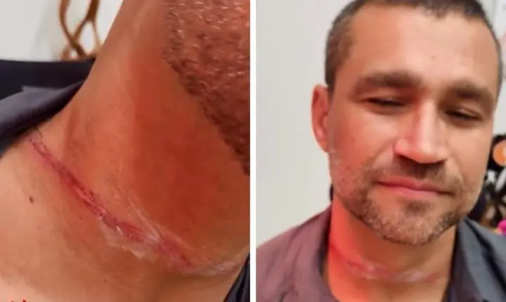 Secretário tem pescoço cortado em acidente causado por fio de telefone