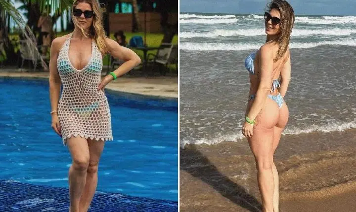 Sheila Mello faz tratamento com colágeno no bumbum: entenda em que casos a técnica realmente funciona