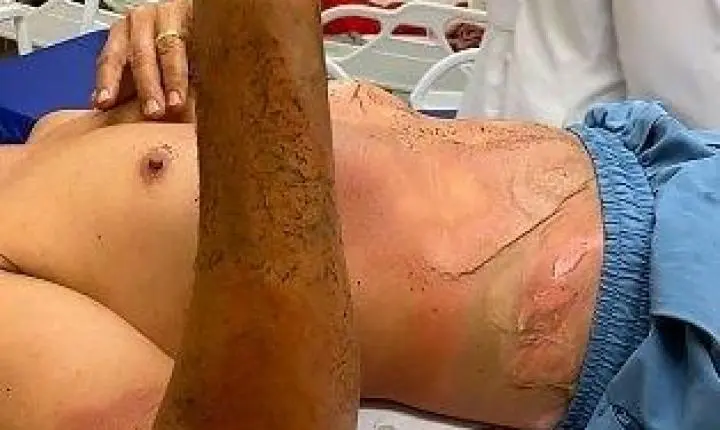 Trabalhador sofre descarga elétrica, cai de andaime e é socorrido às pressas