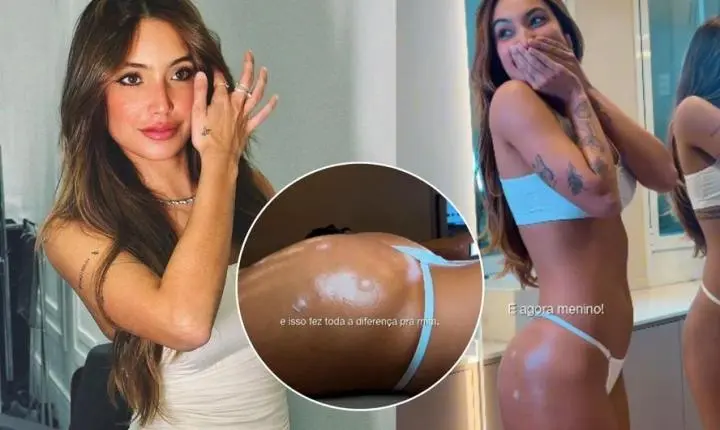 Vanessa Lopes sobre harmonização no bumbum: 'Fez toda a diferença para mim'
